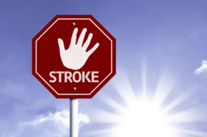 The Warning Signs of a Stroke